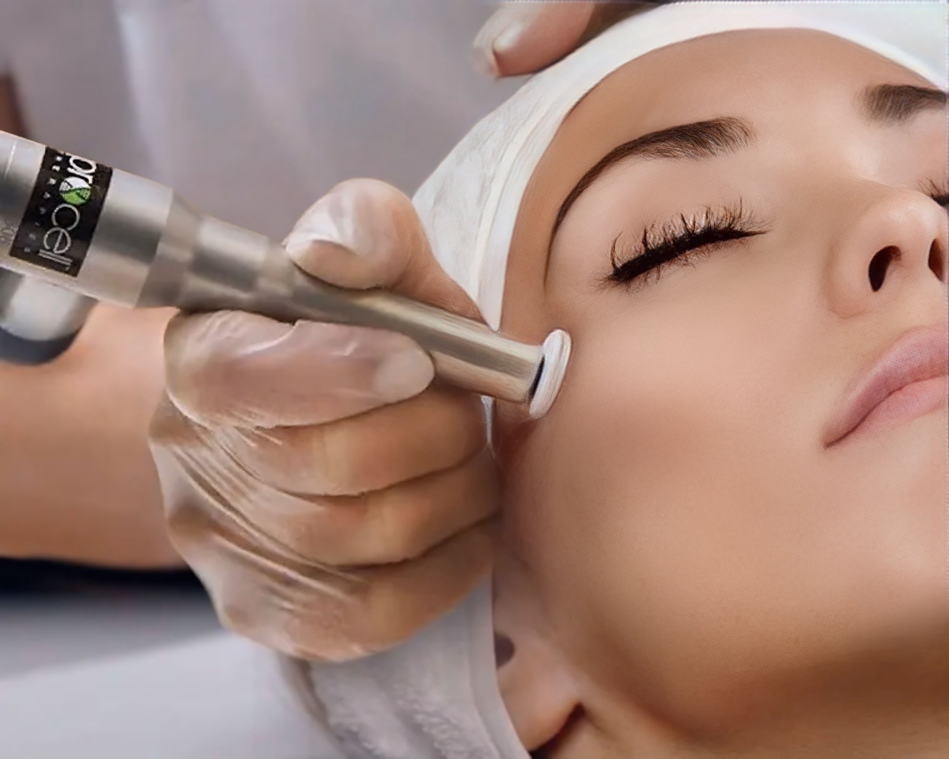 MICROCHANNELING treatment at Balanced Essence Medical Wellness
